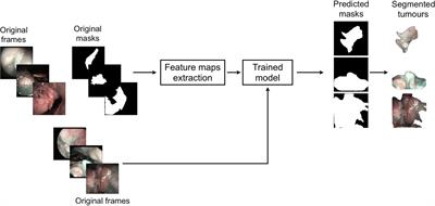 Deep Learning for Automatic Segmentation of Oral and Oropharyngeal Cancer Using Narrow Band Imaging: Preliminary Experience in a Clinical Perspective